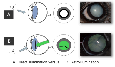 The following image depicts why this angulation will highlight, with the fundic reflex, some changes within the eye, not visible with direct illumination.