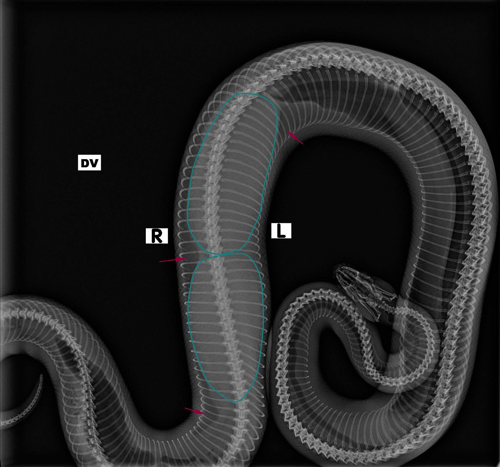 Medium Snake with annot