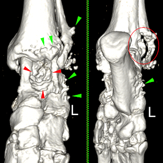 radiograph imahes